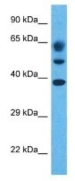 NUDCD3 Rabbit anti-Human, Polyclonal, Novus Biologicals 100 &mu;g; Unconjugated:Antibodies,